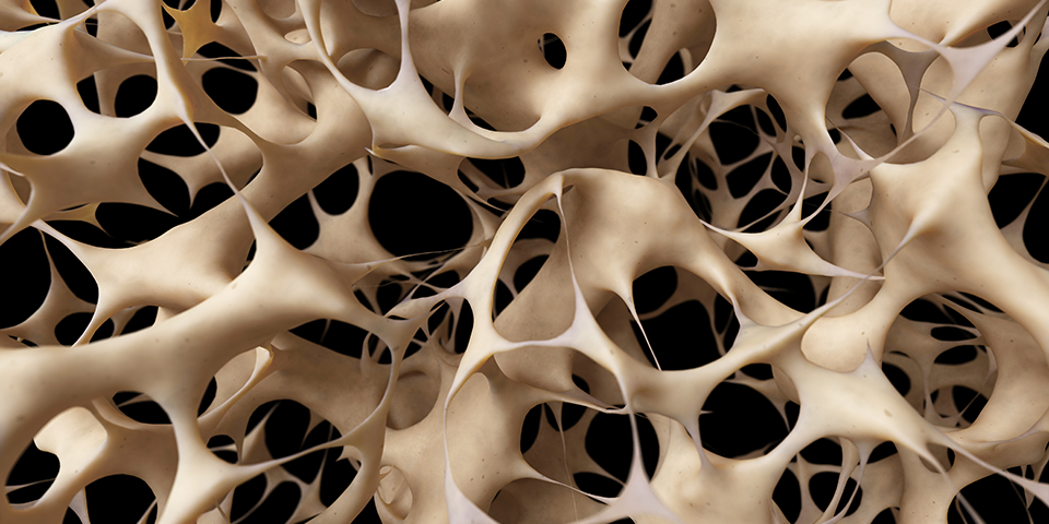 »Imejte radi svoje kosti: Zaščitite svojo prihodnost« - Svetovni dan osteoporoze