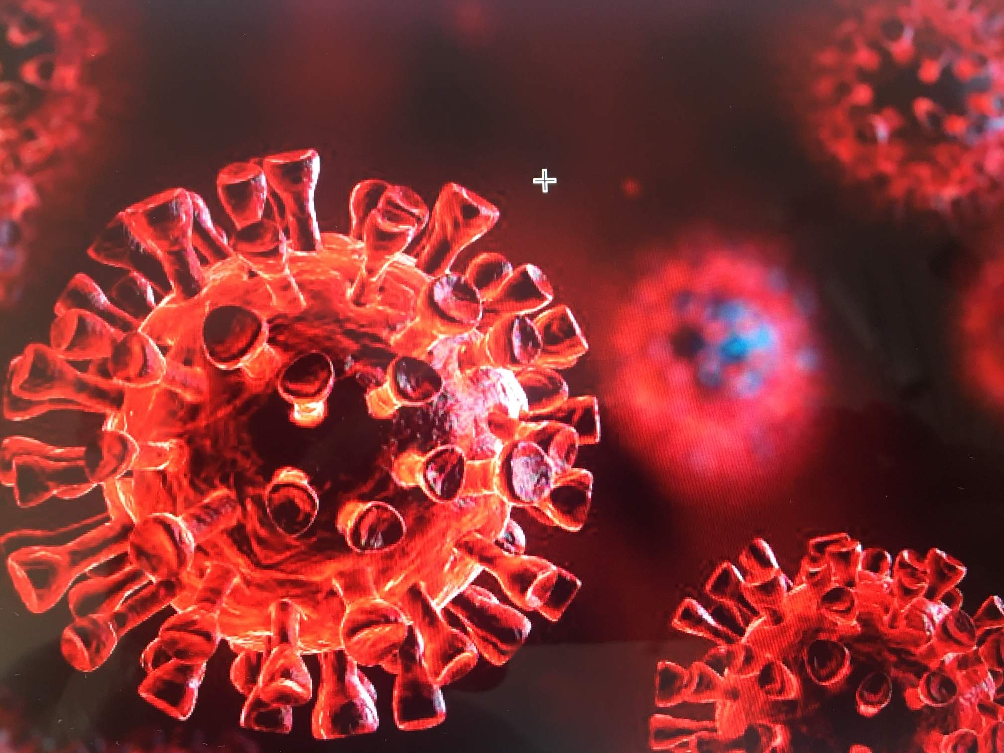 Izbruh nove koronavirusne bolezni   (COVID - 19)