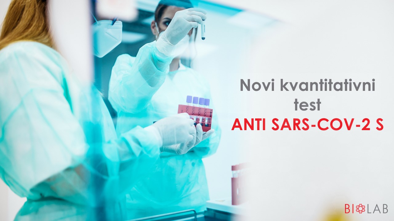 Novi kvantitativni test - ANTI-SARS-CoV-2 S